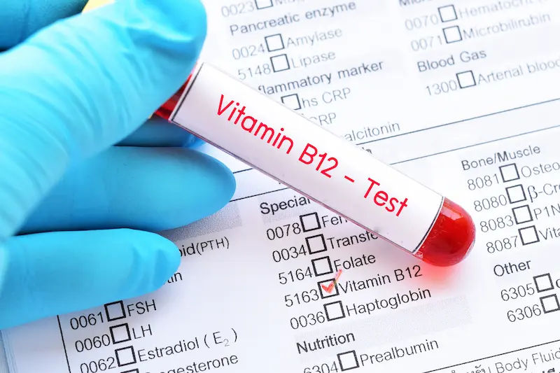 Vitamin B12 Test Overview and Interpretation